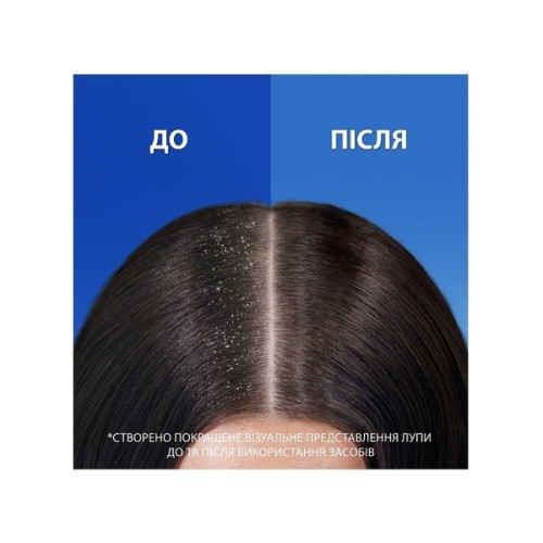 Шампунь Head & Shoulders 2 в 1 Проти лупи Гладке та шовковисте 330 мл (8700216304856)