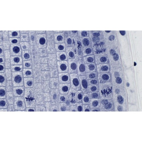 Набір мікропрепаратів Bresser високоякісних 10 шт (5984500) (931509)