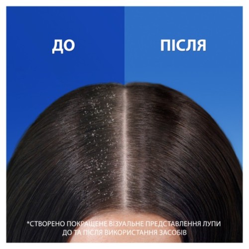 Шампунь Head & Shoulders 2 в 1 Проти лупи Свіжість ментолу 330 мл (8700216304825)