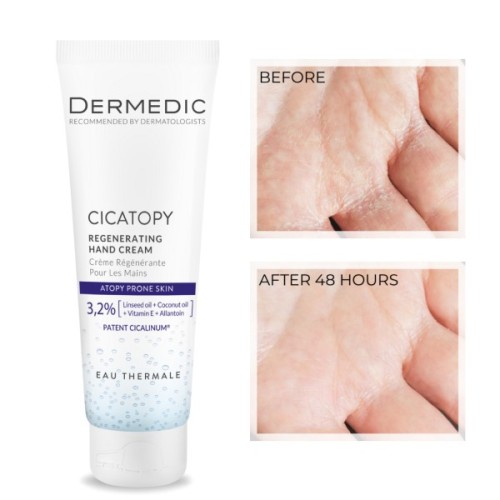Крем для рук Dermedic Cicatopy Відновлювальний 75 мл (5901643176471)