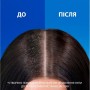 Шампунь Head & Shoulders Pro-Expert 7 Інтенсивний порятунок 250 мл (8700216156844)