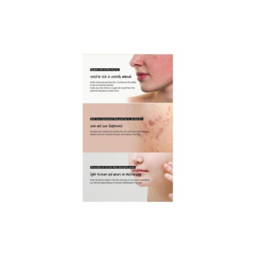 Сироватка для обличчя SKIN1004 Madagascar Centella Ampoule 30 мл (8809913830788)