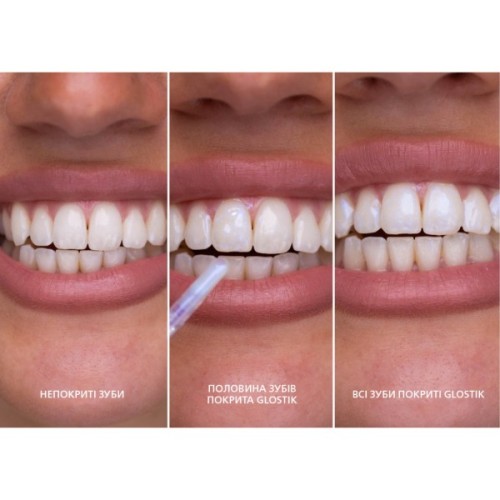 Засіб для відбілювання зубів SmileKit Glostik Блиск для зубів 4 мл (5.3020)
