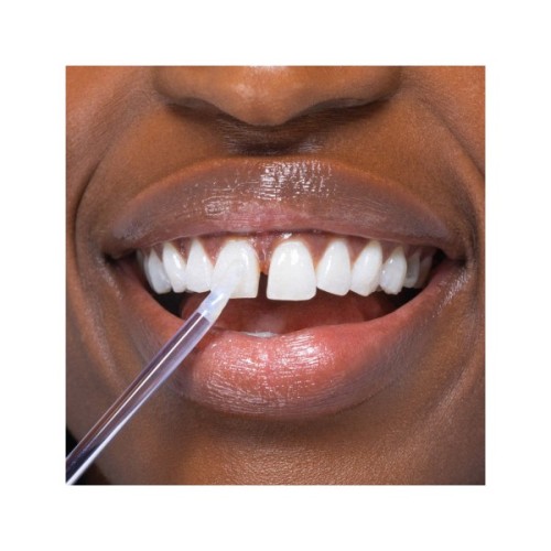 Засіб для відбілювання зубів SmileKit Glostik Блиск для зубів 4 мл (5.3020)