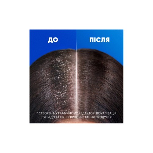 Шампунь Head & Shoulders Для чутливої шкіри 400 мл (5011321336124)