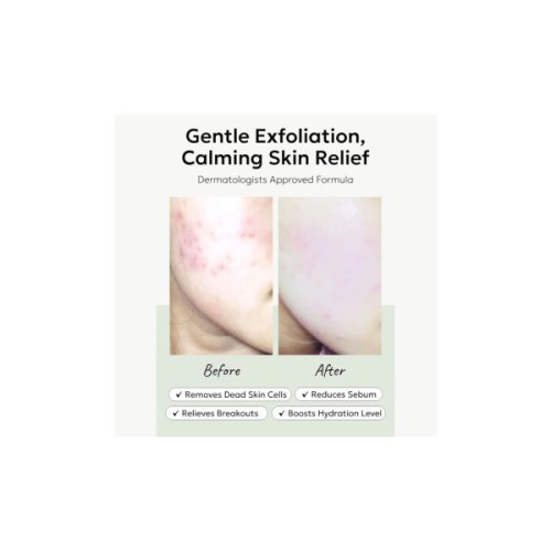 Пілінг для обличчя Celimax Hearleaf BHA Peeling Pad 60 шт (8809463992615)
