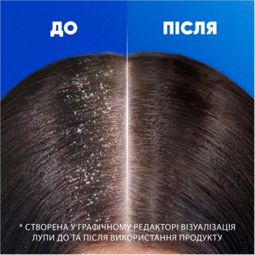 Шампунь Head & Shoulders 2 в 1 Проти лупи Основний догляд 625 мл (8700216304948)