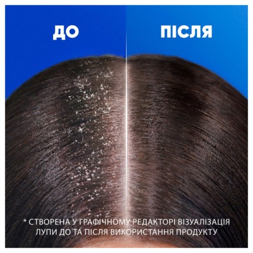 Шампунь Head & Shoulders Глибоке зволоження 400 мл (8001841406688)