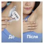 Змінні касети Gillette Venus Pro Smooth Sensitive 3 шт. (8700216968928)