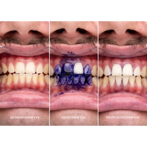 Засіб для відбілювання зубів SmileKit V34 Коректор кольору зубів 30 мл (5.3010)