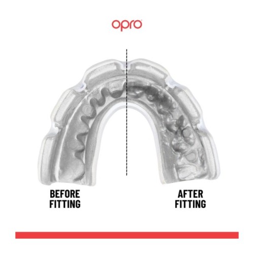 Капа Opro Instant Single Colour Braces Clear (102522007) (Instant_Braces_Clear)