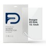 Плівка захисна Armorstandart Anti-Blue hydrogel Doogee U9 Kids 10.1inch (ARM93966)