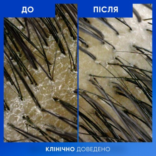 Шампунь Head & Shoulders Clarify & Shine Проти лупи Очищення та блиск 400 мл (8700216658461)