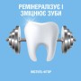 Ополіскувач для порожнини рота Listerine Ультравідбілювання М'який смак 500 мл (3574661491776/3574661491875)
